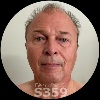 01-Bjorn Seegebarth from Braunschweig Germany - S359-2